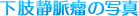 Öᎂ̎ʐ^